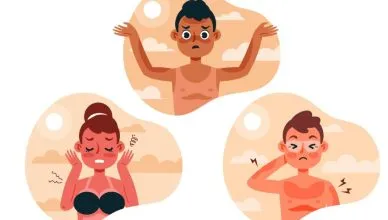 home remedies to remove tan